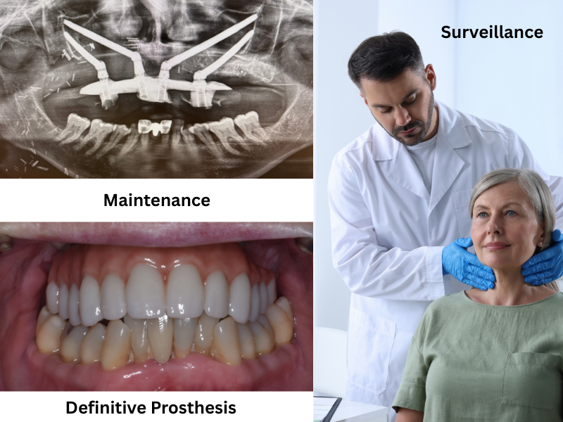 Long-term Follow-up - Ongoing care and monitoring