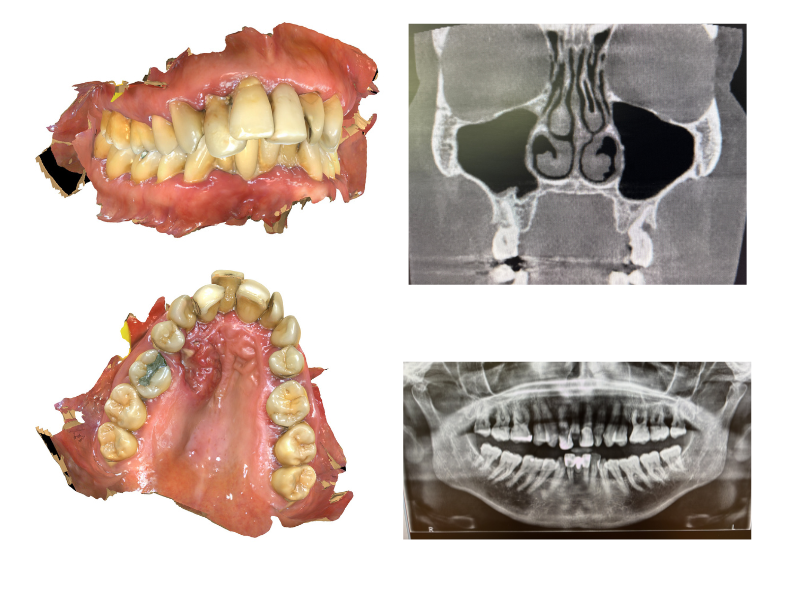 Pre-operative Planning - CT imaging and treatment coordination
