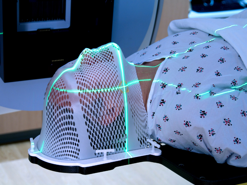 Radiotherapy - Adjuvant treatment when required